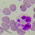 Hematologia 3