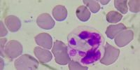Hematologia-3 Hematologia-3